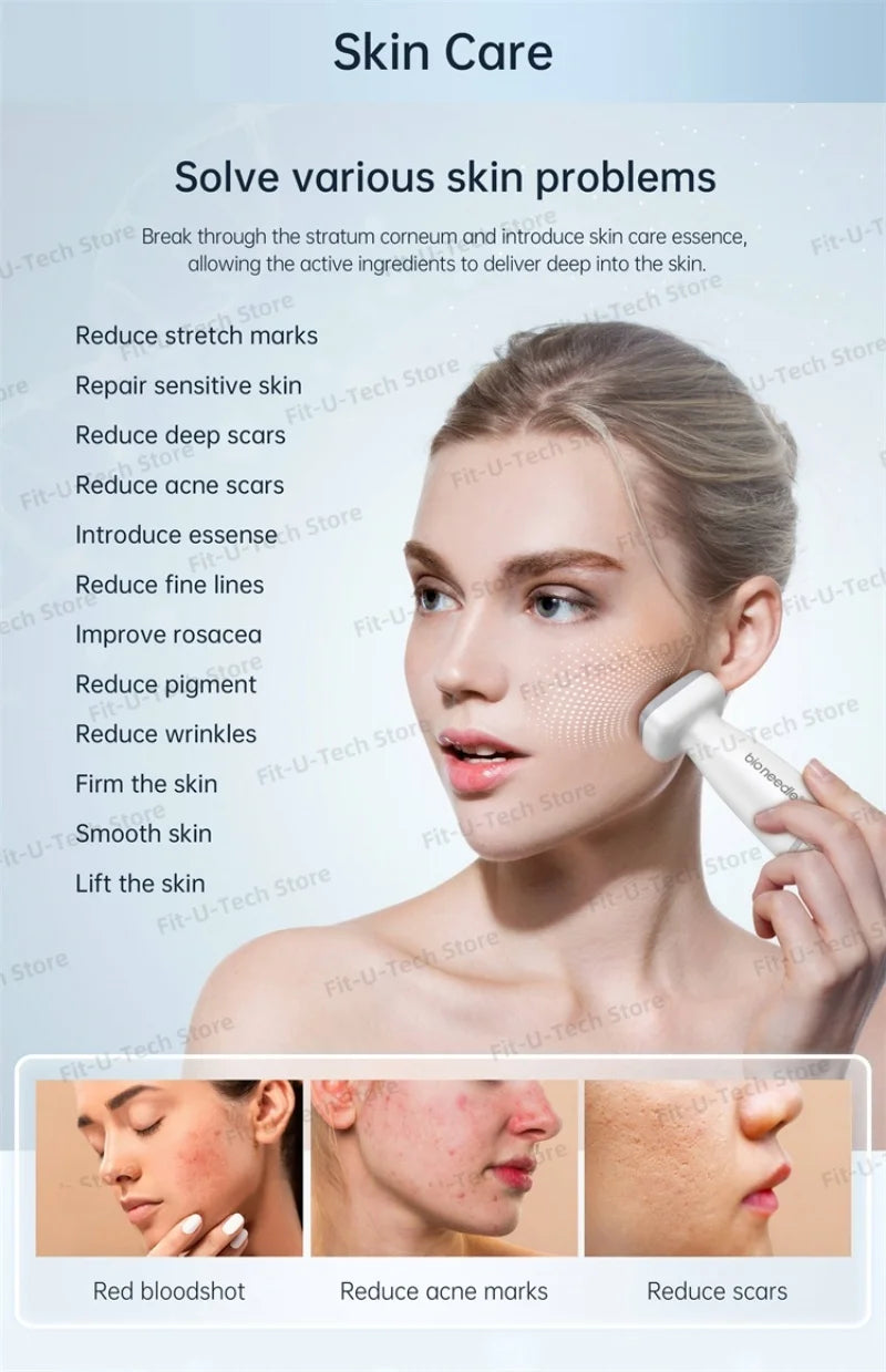 LumiDerm Titanium Roller