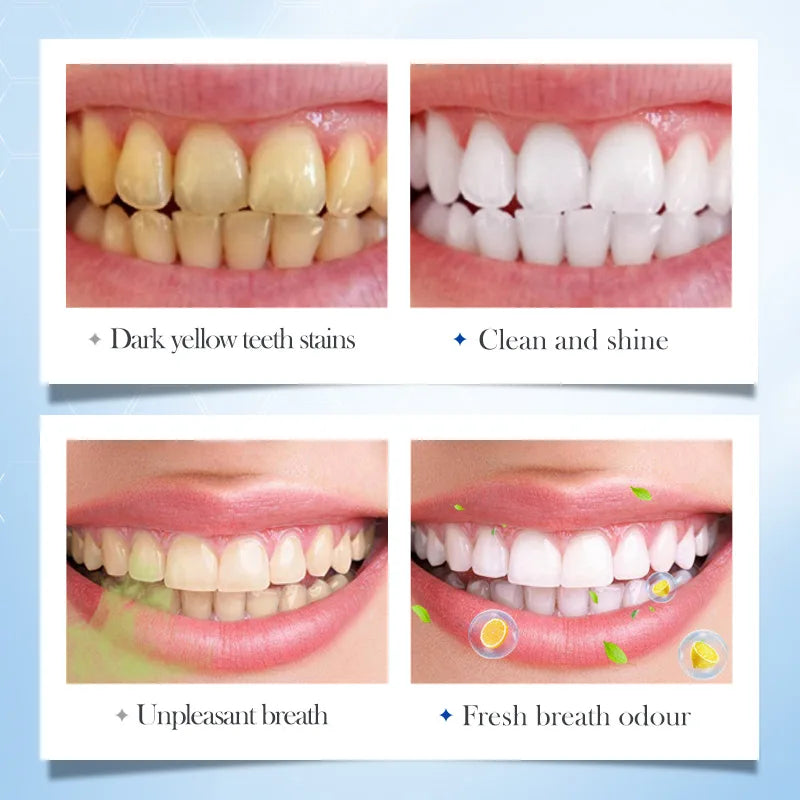 FreshBreath Probiotic Solid